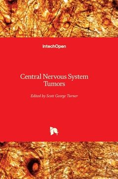 portada Central Nervous System Tumors (en Inglés)