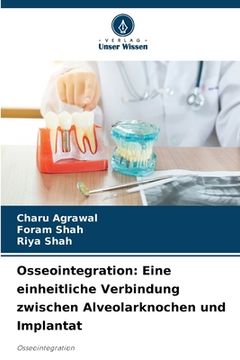 portada Osseointegration: Eine einheitliche Verbindung zwischen Alveolarknochen und Implantat (en Alemán)