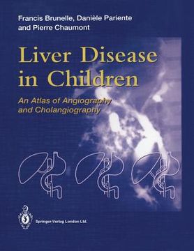 portada Liver Disease in Children: An Atlas of Angiography and Cholangiography (en Inglés)