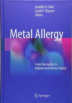 portada Metal Allergy: From Dermatitis to Implant and Device Failure (en Inglés)