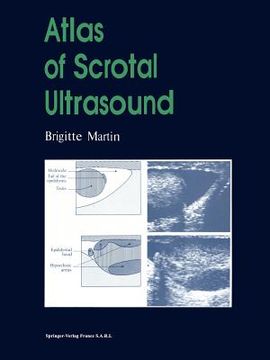 portada Atlas of Scrotal Ultrasound (en Inglés)