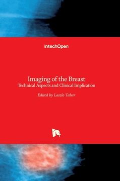 portada Imaging of the Breast: Technical Aspects and Clinical Implication (en Inglés)
