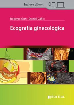 Ecografía Ginecológica (in Spanish)