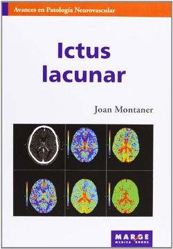 portada Ictus Lacunar (in Spanish)