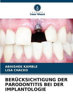portada Berücksichtigung Der Parodontitis Bei Der Implantologie (in German)