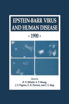 portada Epstein-Barr Virus and Human Disease - 1990 (en Inglés)