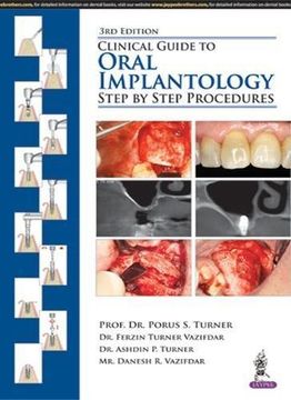 portada CLINICAL GUIDE TO ORAL IMPLANTOLOGY STEP BY STEP PROCEDURES (in English)