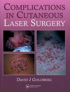 portada Complications in Laser Cutaneous Surgery (en Inglés)