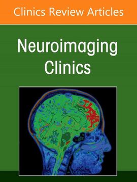 portada Imaging of the Post Treatment Head and Neck, an Issue of Neuroimaging Clinics of North America (Volume 32-1) (Clinics Collections, Volume 32-1) (en Inglés)