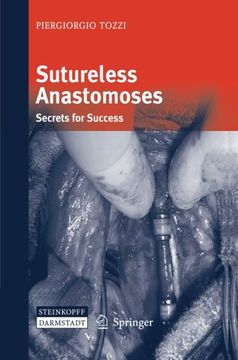portada Sutureless Anastomoses: Secrets for Success
