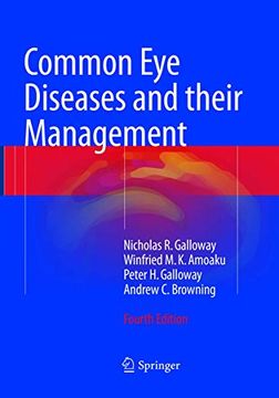 portada Common Eye Diseases and Their Management (en Inglés)
