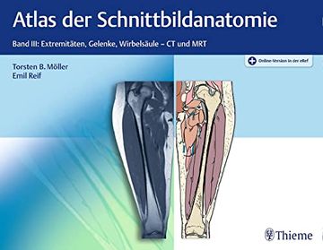 portada Atlas der Schnittbildanatomie: Band Iii: Extremitäten, Gelenke, Wirbelsäule (en Alemán)