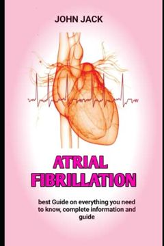 portada atrial fibrillation: The exact condition of the atrial fibrillation