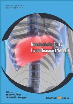 portada Nonalcoholic Fatty Liver Disease (NAFLD) (en Inglés)