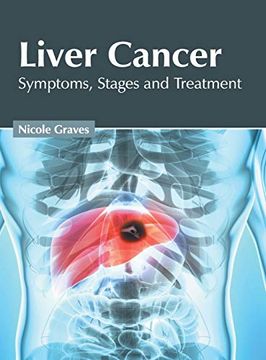 portada Liver Cancer: Symptoms, Stages and Treatment (en Inglés)
