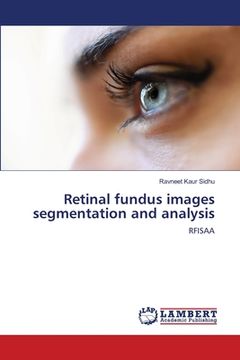 portada Retinal fundus images segmentation and analysis (en Inglés)
