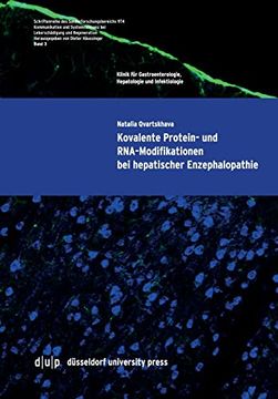 portada Kovalente Protein- und Rna-Modifikationen bei Hepatischer Enzephalopathie (en Alemán)