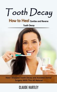 portada Tooth Decay: How to Heal Cavities and Reverse Tooth Decay (How I Stopped Tooth Decay and Avoided Dental Surgery With This All Natur (in English)
