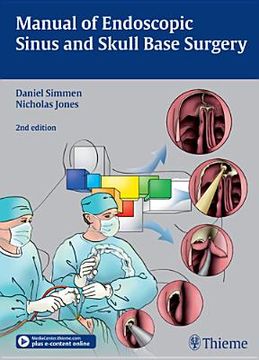 portada Manual of Endoscopic Sinus and Skull Base Surgery (in English)