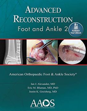 portada Advanced Reconstruction: Foot and Ankle 2: Print + eBook (en Inglés)