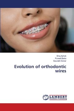 portada Evolution of orthodontic wires (en Inglés)
