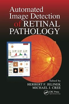 portada Automated Image Detection of Retinal Pathology (en Inglés)