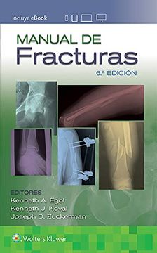 portada Manual de Fracturas (in Spanish)