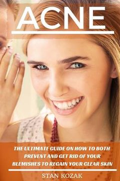portada Acne: The Ultimate Guide on How To Both Prevent and Get Rid Of Your Blemishes to Regain Your Clear Skin (in English)