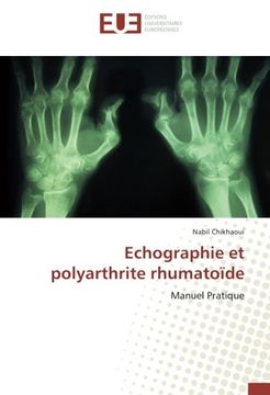 portada Echographie et polyarthrite rhumatoïde (OMN.UNIV.EUROP.)