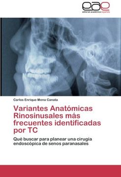portada Variantes Anatomicas Rinosinusales Mas Frecuentes Identificadas Por Tc