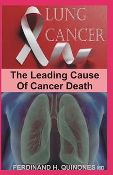 portada Lung Cancer: All You Need to Know about the Leading Cause of Cancer Death (en Inglés)