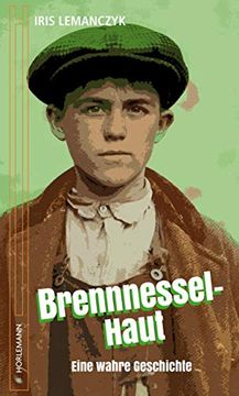 portada Brennnessel Haut: Eine Wahre Geschichte (en Alemán)