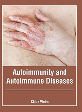 portada Autoimmunity and Autoimmune Diseases (en Inglés)