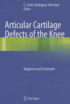 portada articular cartilage defects of the knee: diagnosis and treatment (in English)