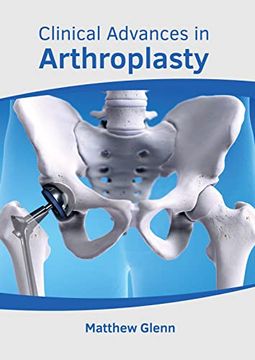 portada Clinical Advances in Arthroplasty 