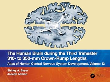 portada The Human Brain During the Third Trimester 310– to 350–Mm Crown-Rump Lengths: Atlas of Central Nervous System Development, Volume 13 (Atlas of Central Nervous System Development, 13) (en Inglés)