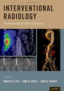 portada Interventional Radiology: Fundamentals of Clinical Practice (en Inglés)