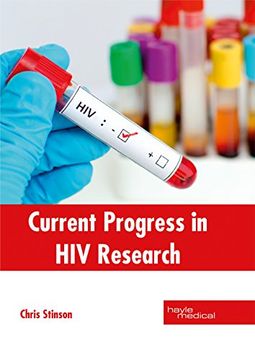 portada Current Progress in hiv Research (en Inglés)