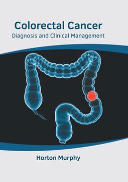 portada Colorectal Cancer: Diagnosis and Clinical Management 