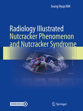 portada Radiology Illustrated: Nutcracker Phenomenon and Nutcracker Syndrome (in English)
