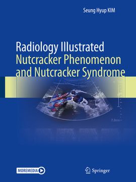 portada Radiology Illustrated: Nutcracker Phenomenon and Nutcracker Syndrome (en Inglés)