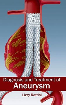 portada Diagnosis and Treatment of Aneurysm (en Inglés)
