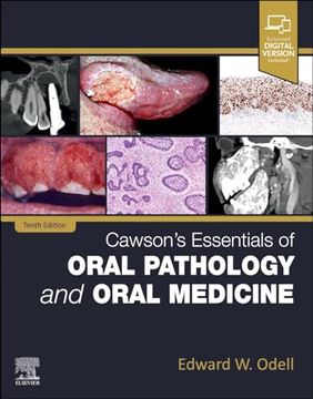 portada Cawson's Essentials of Oral Pathology and Oral Medicine (en Inglés)
