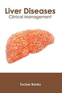 portada Liver Diseases: Clinical Management (in English)