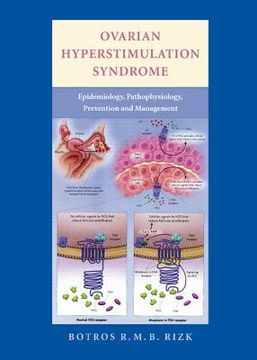 portada Ovarian Hyperstimulation Syndrome: Epidemiology, Pathophysiology, Prevention and Management (in English)