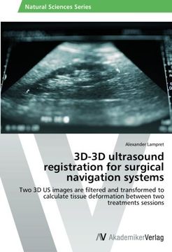 portada 3D-3D ultrasound registration for surgical navigation systems