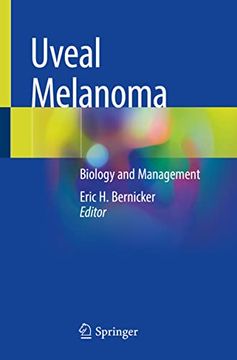 portada Uveal Melanoma: Biology and Management (en Inglés)