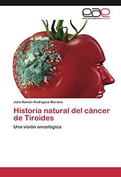 portada Historia Natural del Cáncer de Tiroides: Una Visión Oncológica