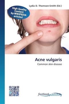 portada Acne vulgaris (en Inglés)