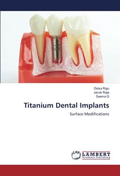 portada Titanium Dental Implants: Surface Modifications (en Inglés)